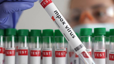 Burundi-171-cas-de-mpox-confirmes.