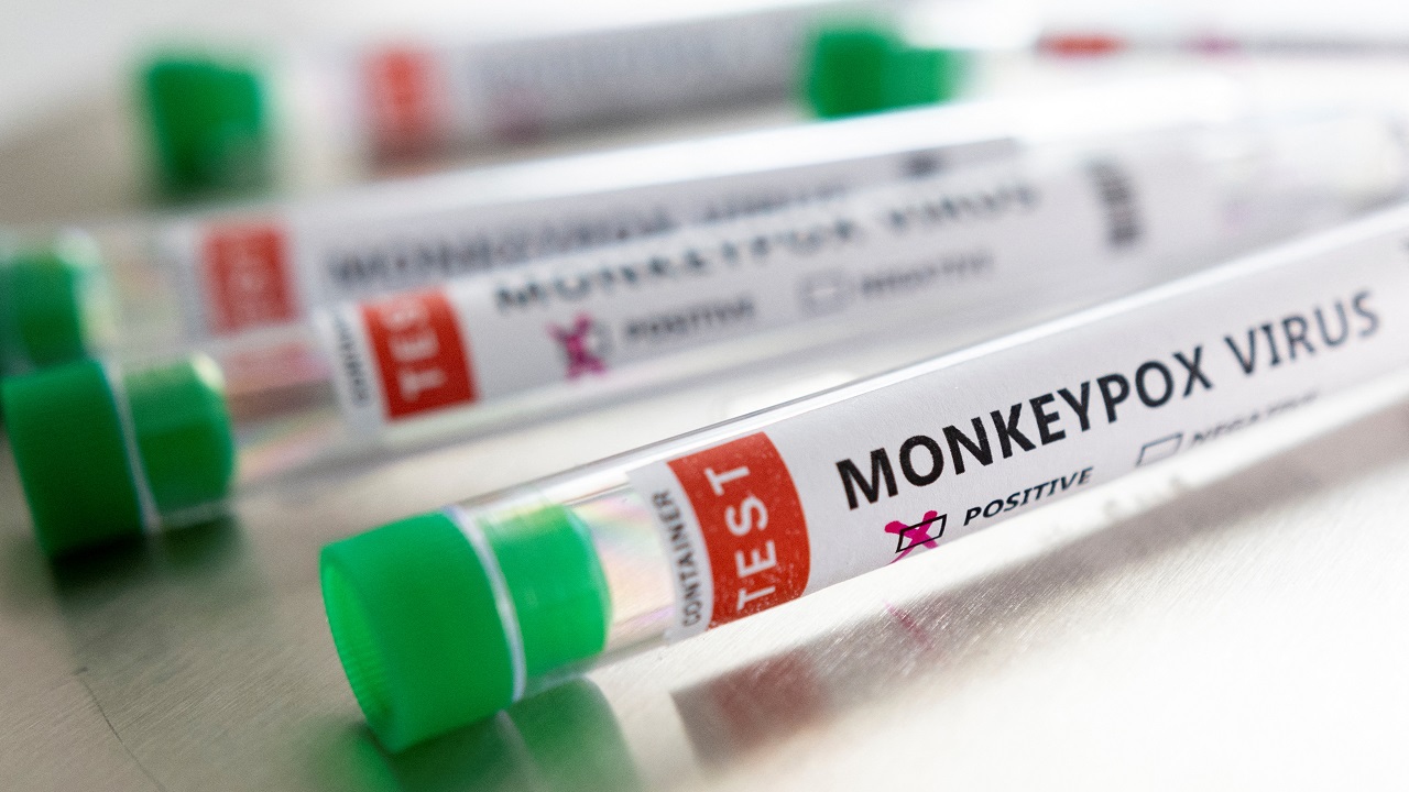 جدري القردة