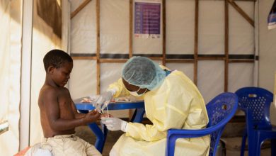 جدري القردة