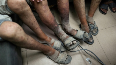 Les détenus palestiniens libérés des prisons sionistes souffrent de complications de santé