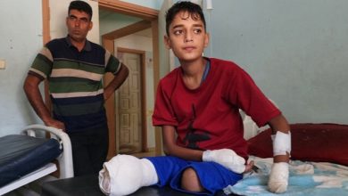 ghaza plus de 8000 personnes amputées depuis le début de l'agression génocidaire sioniste