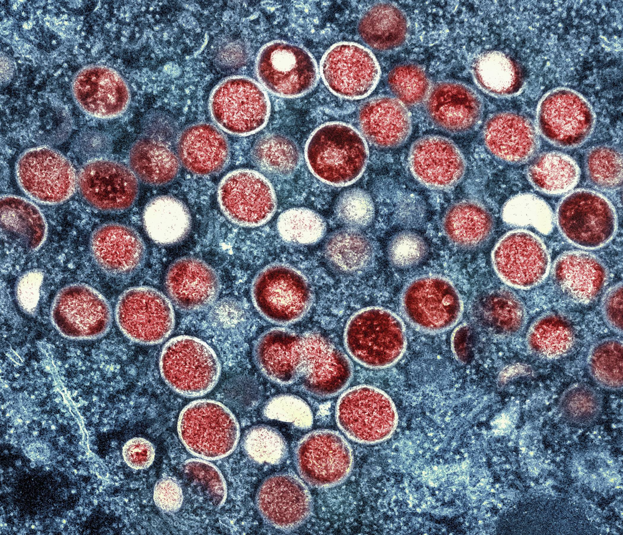 Africa CDC Issues Urgent Warning on Mpox Outbreak and Calls for Resources
