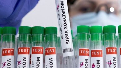 جدري القردة