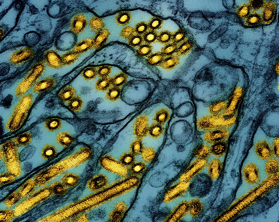 First Severe Bird Flu Case in the US: Louisiana Resident Hospitalized