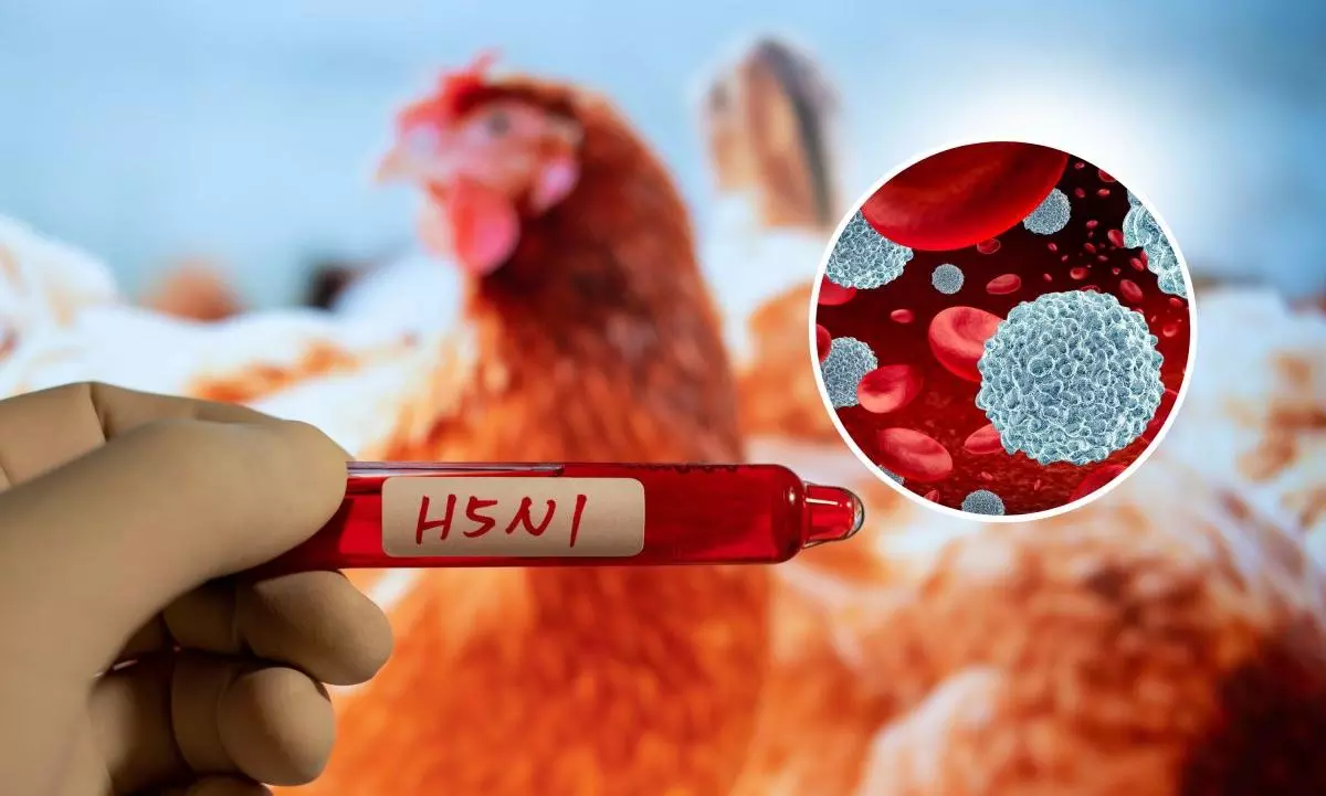 H5N1