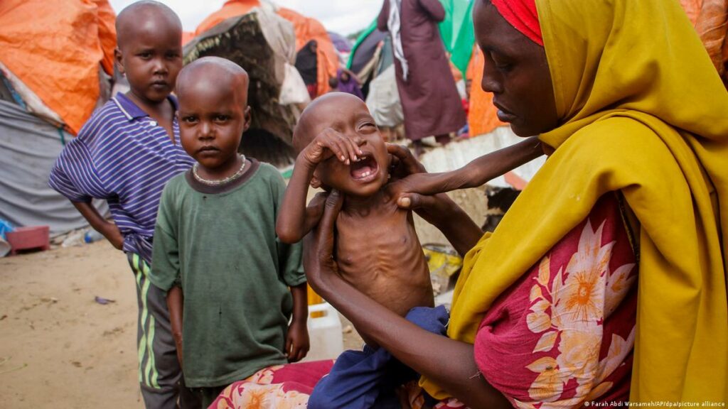 UNICEF: Severe Child Malnutrition Doubled in North Darfur in One Year
