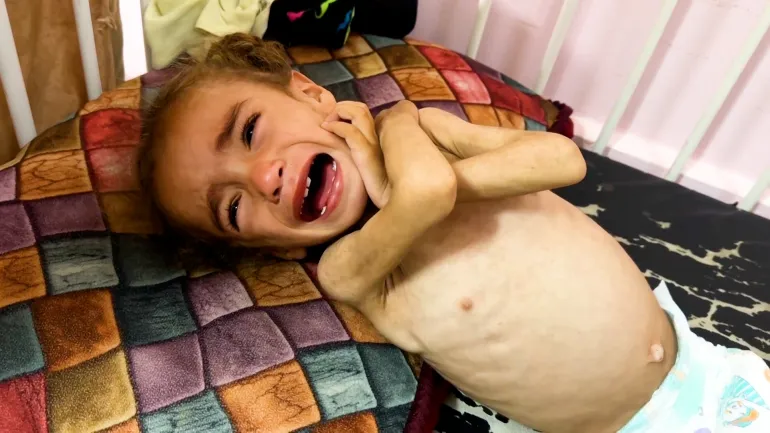 "الأونروا": حصار غزة يحصد أرواح الأطفال ويشل النظام الصحي