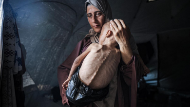 المجاعة تتفشى في قطاع غزة