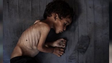 المجاعة تفتك بأطفال غزة