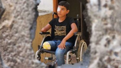 الصحة العالمية: آلاف الفلسطينيين بُترت أطرافهم جراء عدوان الاحتلال على غزة