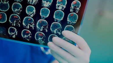 اكتشاف دواء جديد لعلاج نوع خطير من سرطان المخ