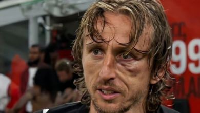 الكرواتي لوكا مودريتش يتعرض لكسر في عظم الوجنة الأيسر